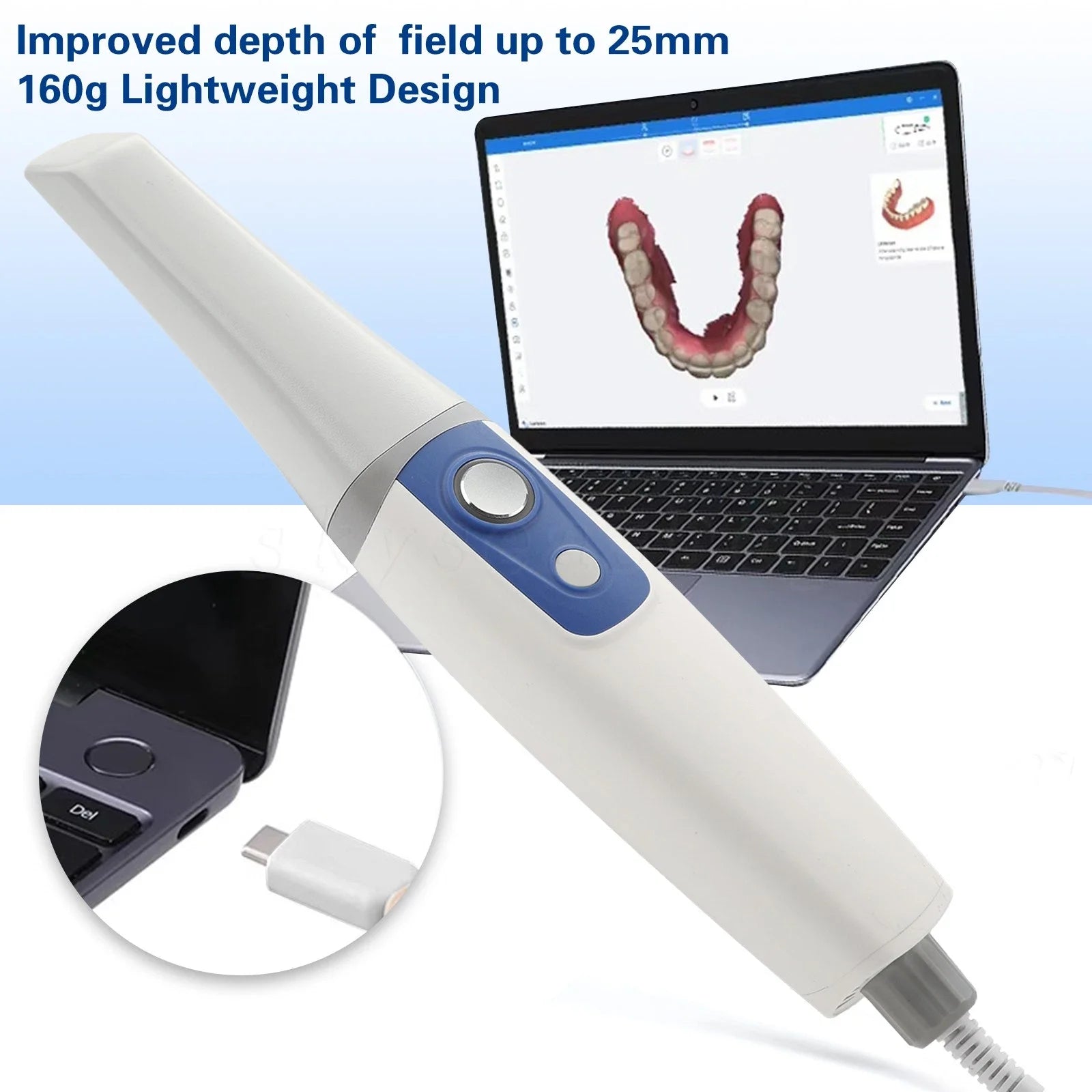 AI 3D Intra-oral Dental Scanner