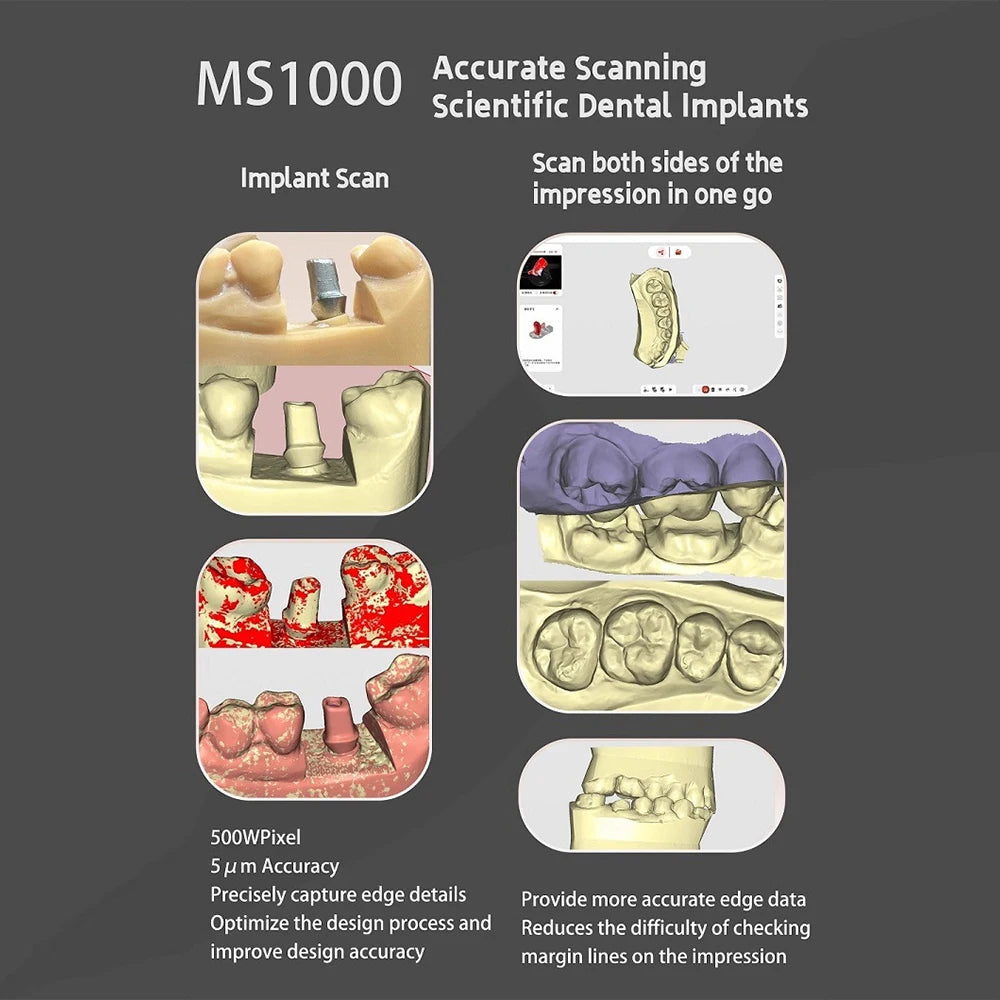 Dental 3D Impression Scanner