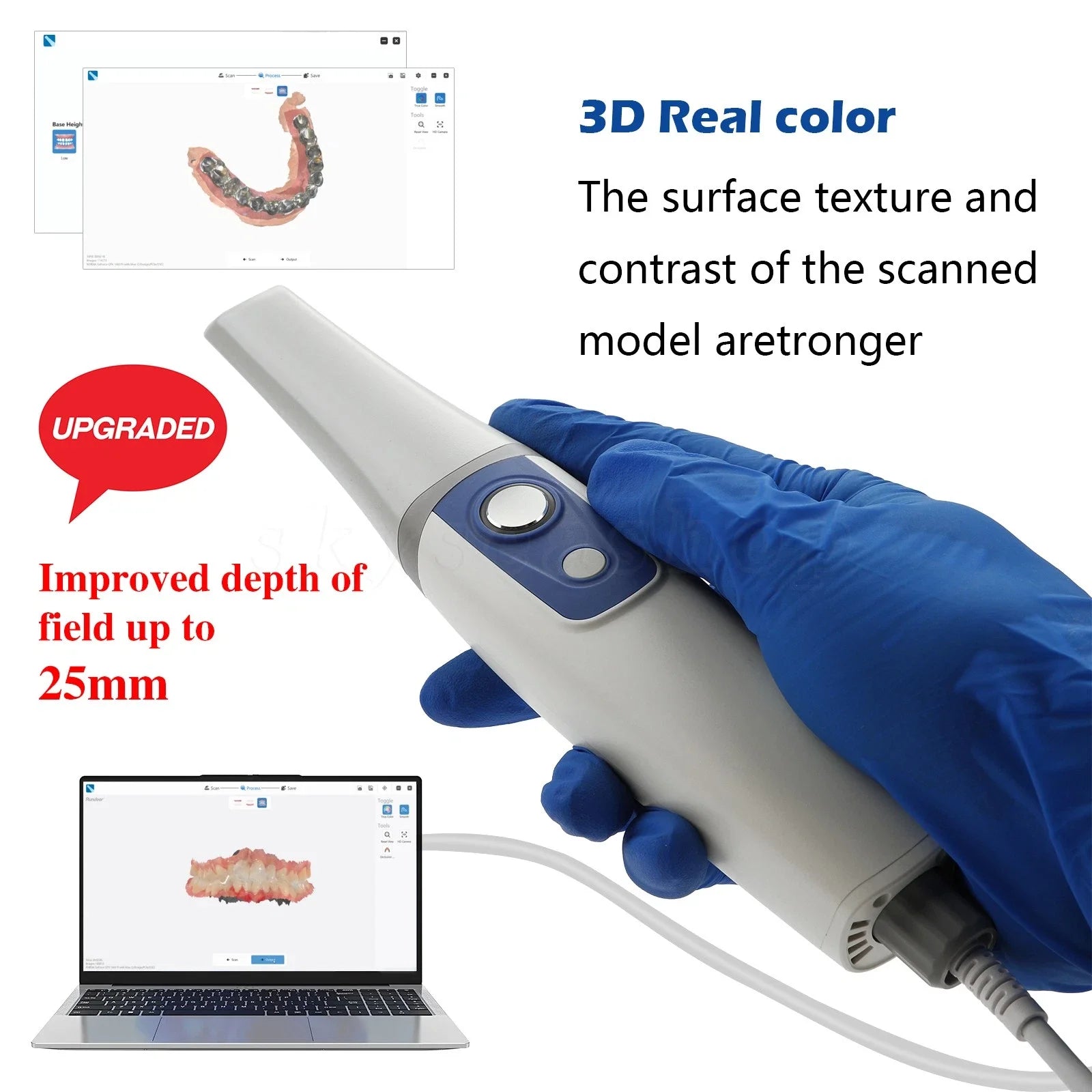 AI 3D Intra-oral Dental Scanner